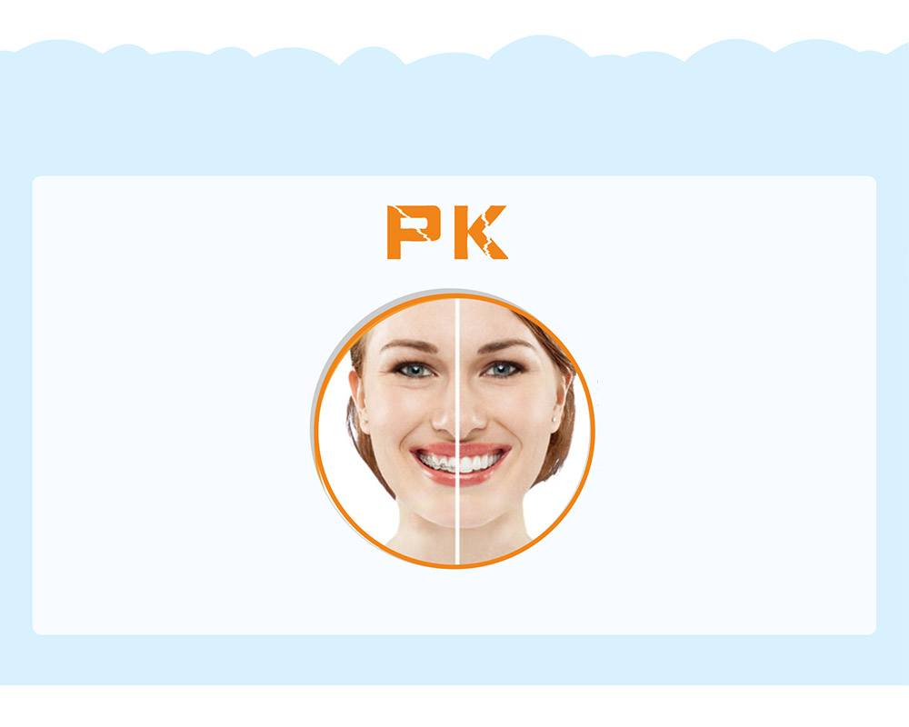传统钢丝牙套PK隐形矫正牙套
