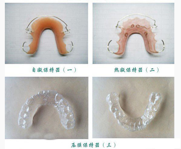 牙齿保持器是什么