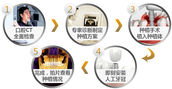 即刻种植牙的过程