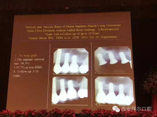王大源教授分享课