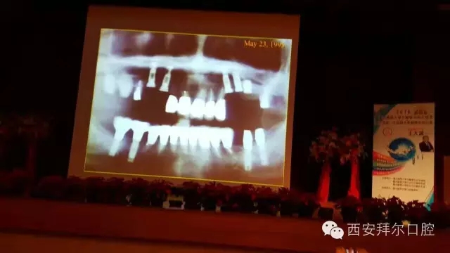 王大源教授分享课
