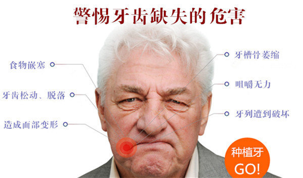 种植牙能用一辈子吗