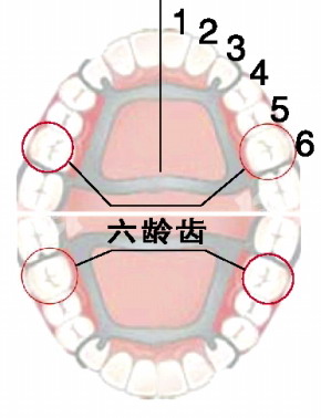 第一颗恒牙－－－“六龄齿
