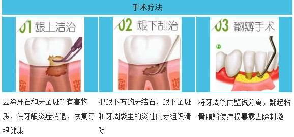 西安得了牙龈炎怎么治