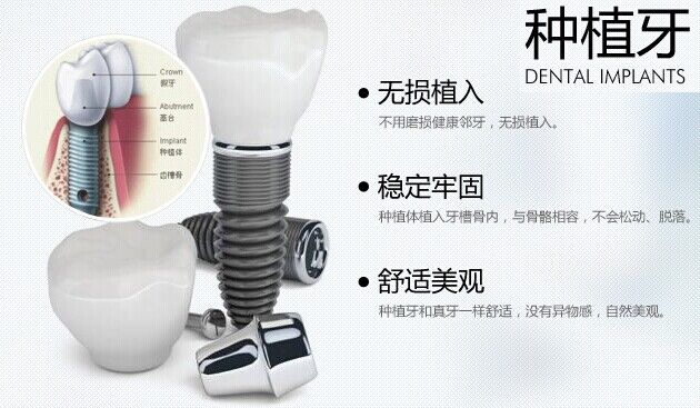 全口牙缺失，种植牙修复优势多