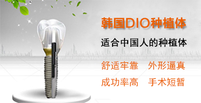 种植牙你应该知道的