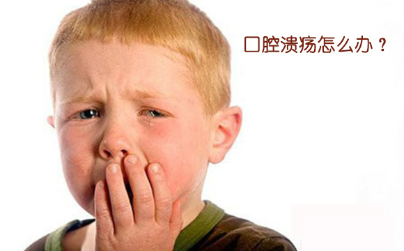 口腔溃疡该怎么办