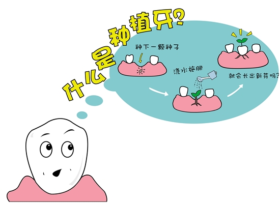 什么是种植牙