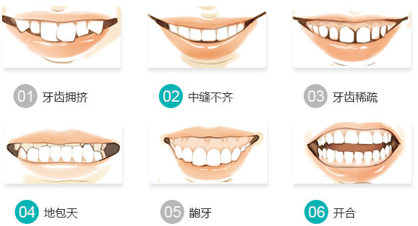 牙齿不齐有哪些严重的危害