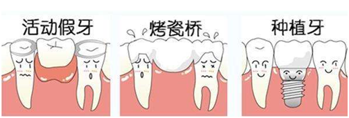 哪种镶牙方式好