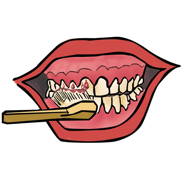 牙龈出血有六因 保持口腔卫生可预防