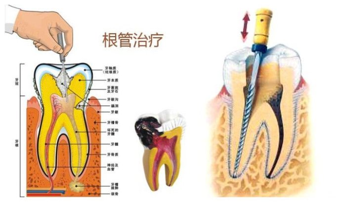 牙周病可做正畸吗